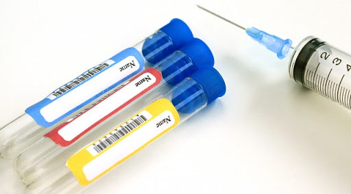 リーキーガットの検査