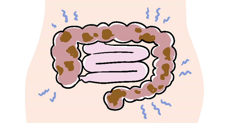 腸内環境が乱れると、身体にどんな影響が？
