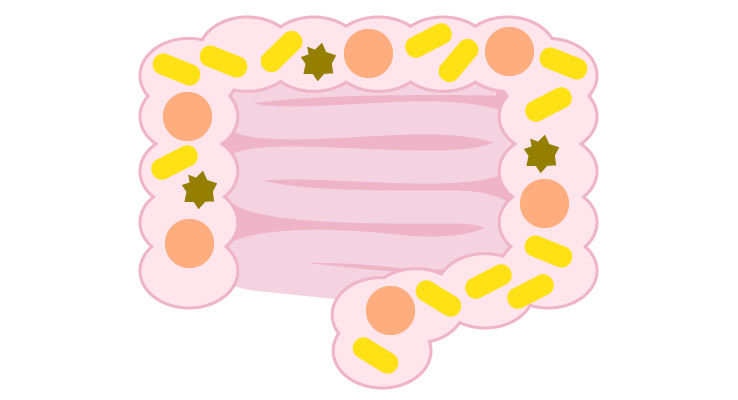 乳酸菌・ビフィズス菌で腸内環境改善