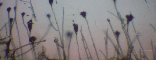 麹菌に毒性は無いのか？